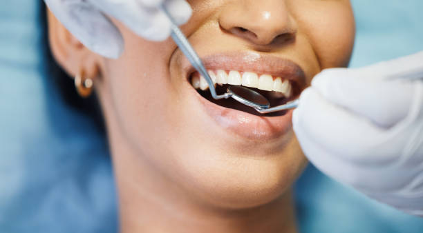 Best Dental Abscess Treatment in Napoleon, OH