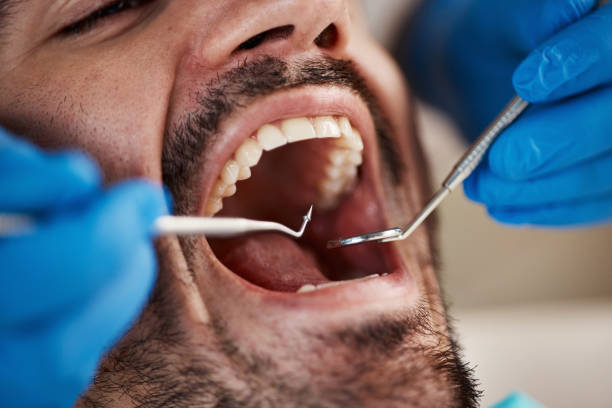 Best Emergency Treatment for Oral Infections in Napoleon, OH